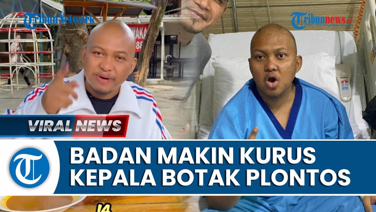 Video Potret Babe Cabita Sebelum Meninggal Dunia Badan Tampak Kurus