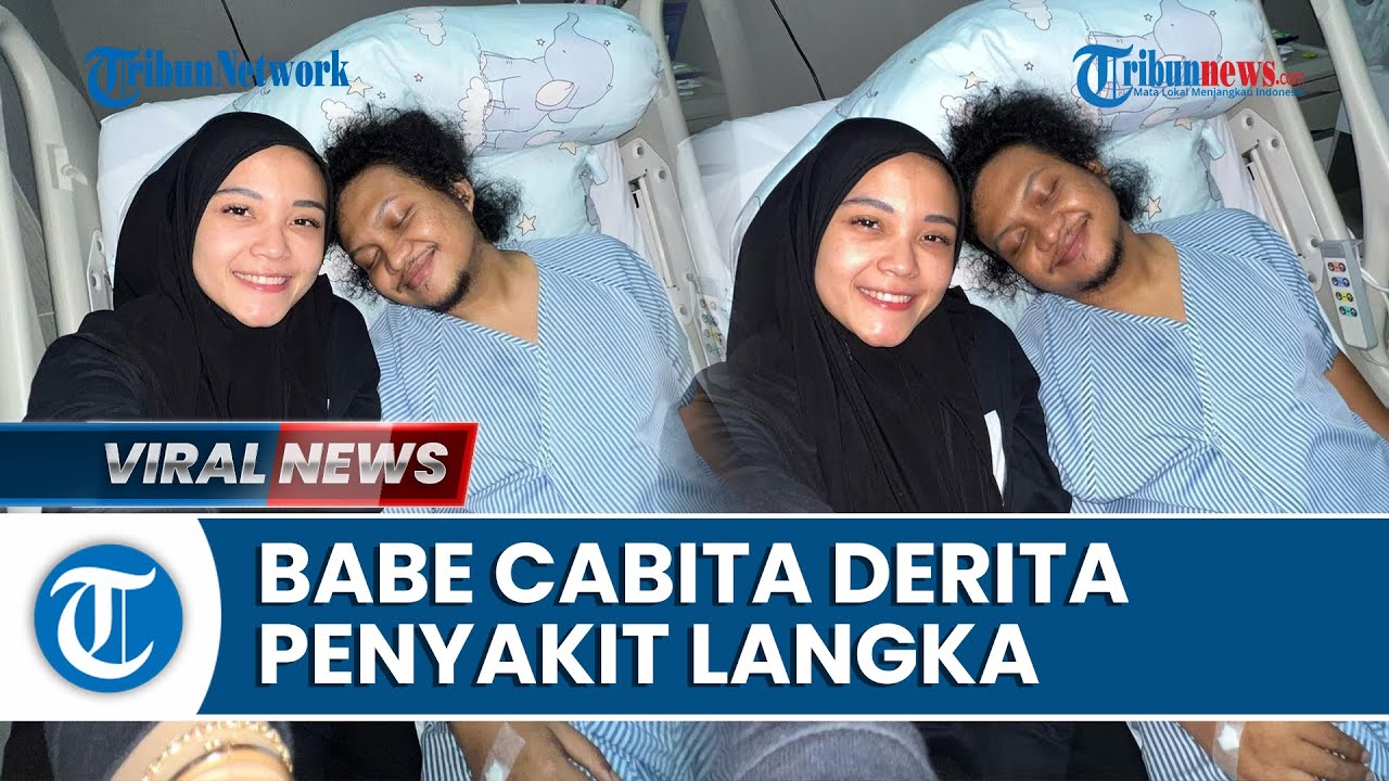 Video Babe Cabita Meninggal Dunia Sempat Sakit Autoimun Langka Hingga