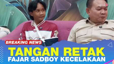 Kronologi Kecelakaan Fajar Sad Boy, Alami Retak Di Tangan Kiri Dan Luka Di Lutut