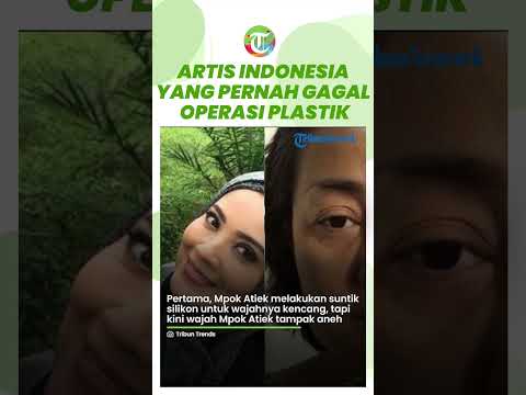 Deretan Artis Indonesia Oplas tapi Gagal, Hidung Miring & Bernanah, Ngaku Efek Dipukuli karena Malu