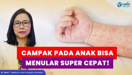 Campak pada Anak: Cara Penularan dan Pengobatan yang Tepat