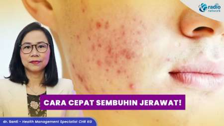 Cara Cepat Sembuhkan Jerawat dan Obat yang Terbukti Ampuh