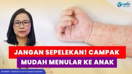Waspada Campak pada Anak! Ini Cara Penularan & Perawatannya