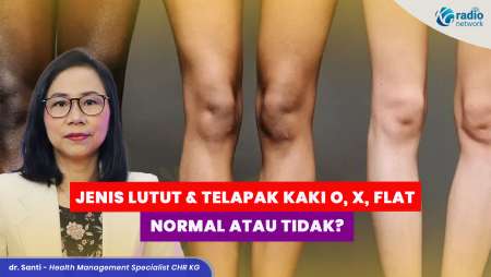 Jenis Lutut & Telapak Kaki O, X, Flat yang Wajar dan Tidak Wajar
