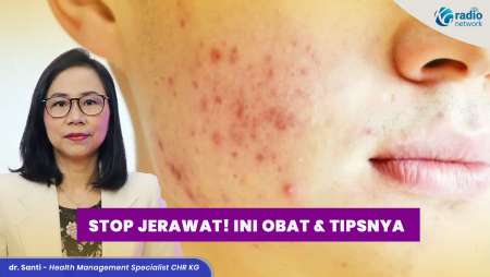 Solusi Jerawat: Tips Sembuh dan Obat yang Tepat!