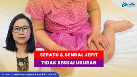 Penyebab Bentuk Kaki X dan O dari Masa Kecil Sampai Dewasa