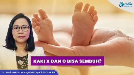 Kaki X & O: Berbahaya atau Tidak? Bisa Disembuhkan?