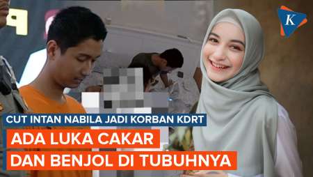 Hasil Visum Intan Nabila Korban KDRT Suami: Luka Cakar di Punggung dan Benjolan di Kepala