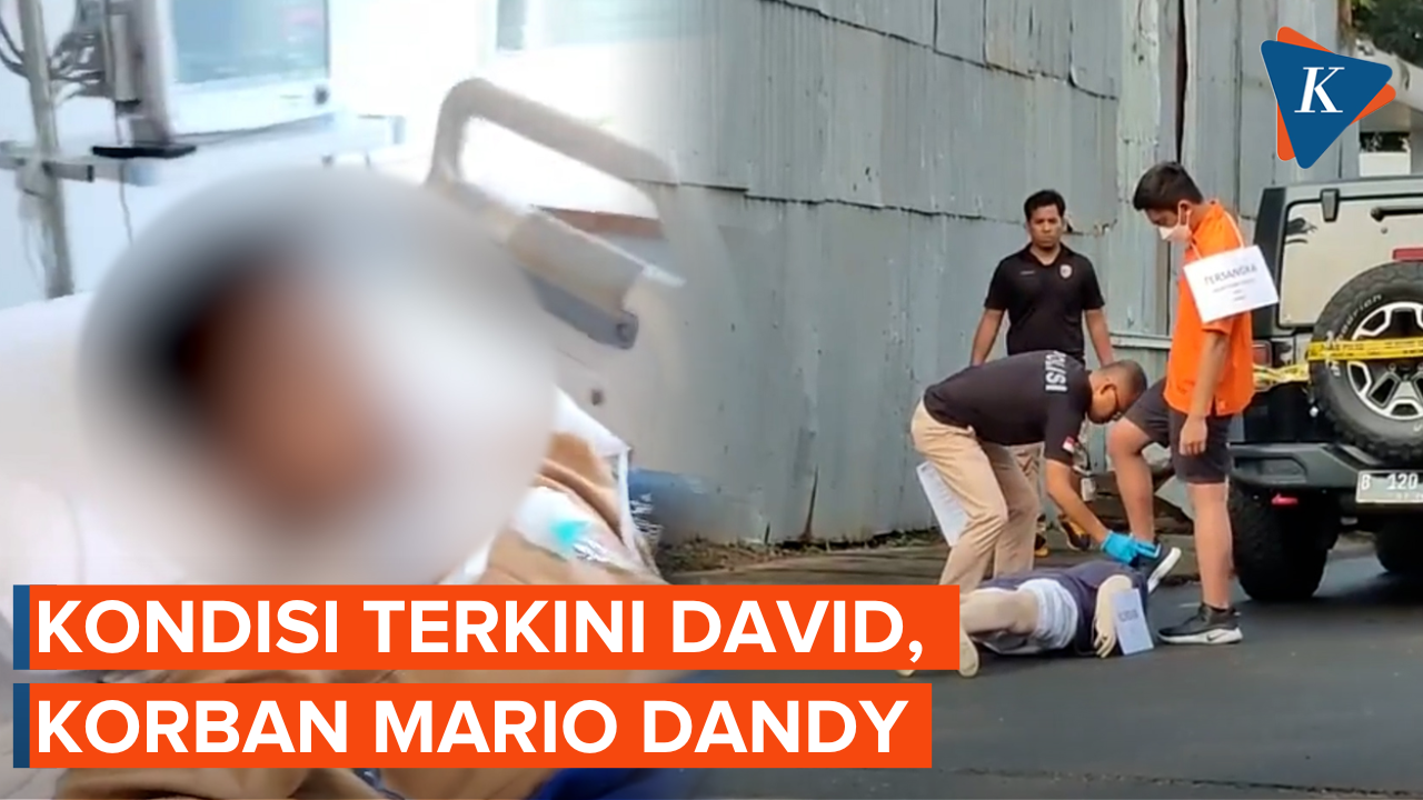 Update Kondisi Terkini David Korban Penganiayaan Mario Dandy Satriyo