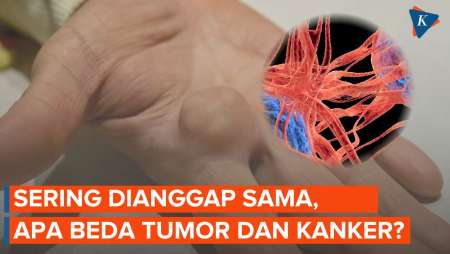 Sering Dianggap Sama, Ini Beda Tumor dan Kanker