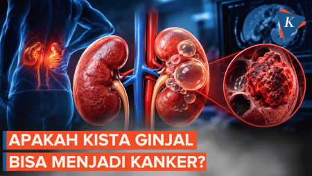 Apakah Kista Ginjal Bisa Menjadi Kanker? Ini Penjelasannya