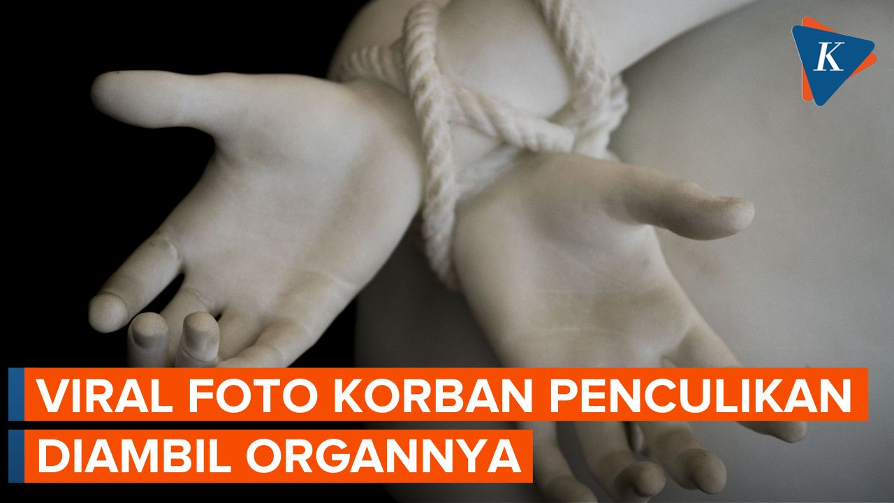 Viral Foto Anak Korban Penculikan Diambil Organnya di Depok Dipastikan Hoaks