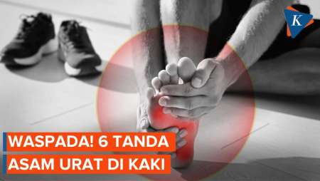 6 Ciri-ciri Asam Urat di Kaki, Gejalanya Seperti Ini…