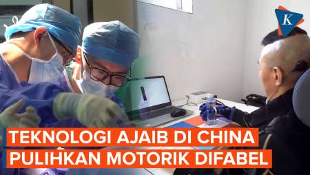 Tim Medis China Berhasil Pulihkan Sistem Motorik Pria Lumpuh Pakai Teknologi Ini