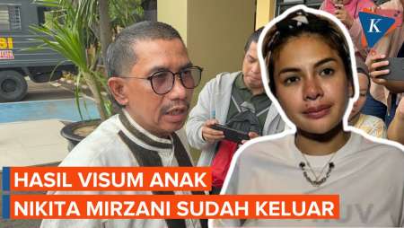 Hasil Visum Anak Nikita Mirzani Sudah Keluar, Pengacara Singgung Perlindungan