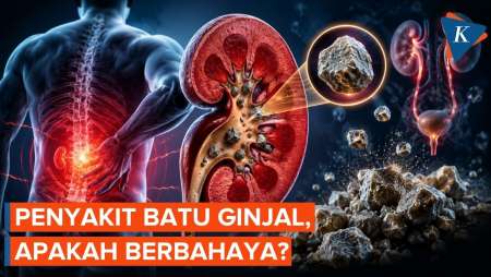 Apakah Penyakit Batu Ginjal Berbahaya?