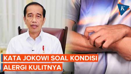Jokowi Jelaskan Kondisi Alergi Kulit yang Dialaminya Usai Pulang dari Vatikan