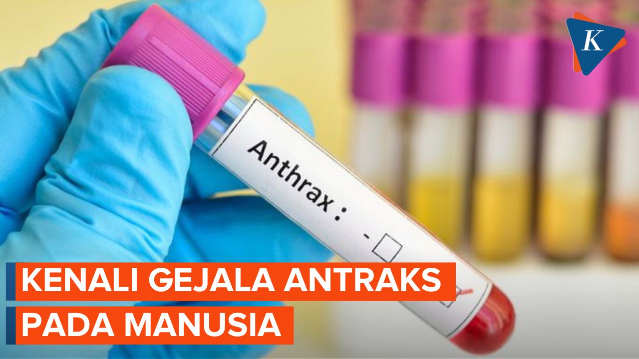 Video Apa Saja Gejala Antraks Yang Perlu Diwaspadai 9601