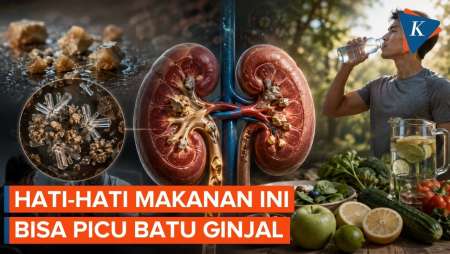 Waspada! Makanan Ini Bisa Memicu Batu Ginjal