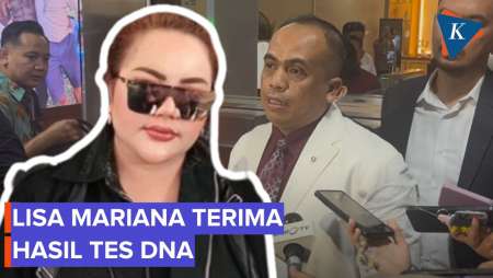 Kuasa Hukum Sebut Lisa Mariana Terima Hasil Tes DNA, tapi Pertimbangkan Second Opinion