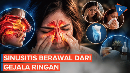 Sering Pilek Dan Sakit Kepala? Kenali Gejala Sinusitis