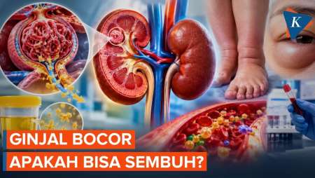 Ginjal Bocor Apakah Bisa Sembuh?
