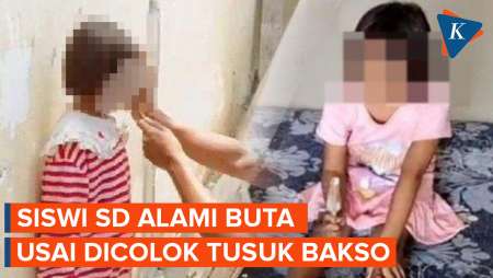 Miris! Siswi SD Buta Usai Dicolok Tusuk Bakso oleh Kakak Kelasnya