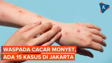 Cacar Monyet di Indonesia, Kesadaran Masyarakat Masih Rendah