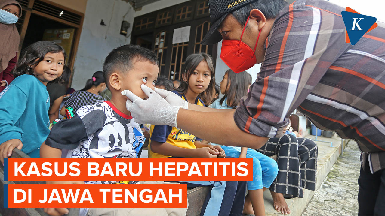 Update Kasus Hepatitis Satu Balita di Jateng Diduga Terpapar Hepatitis Akut