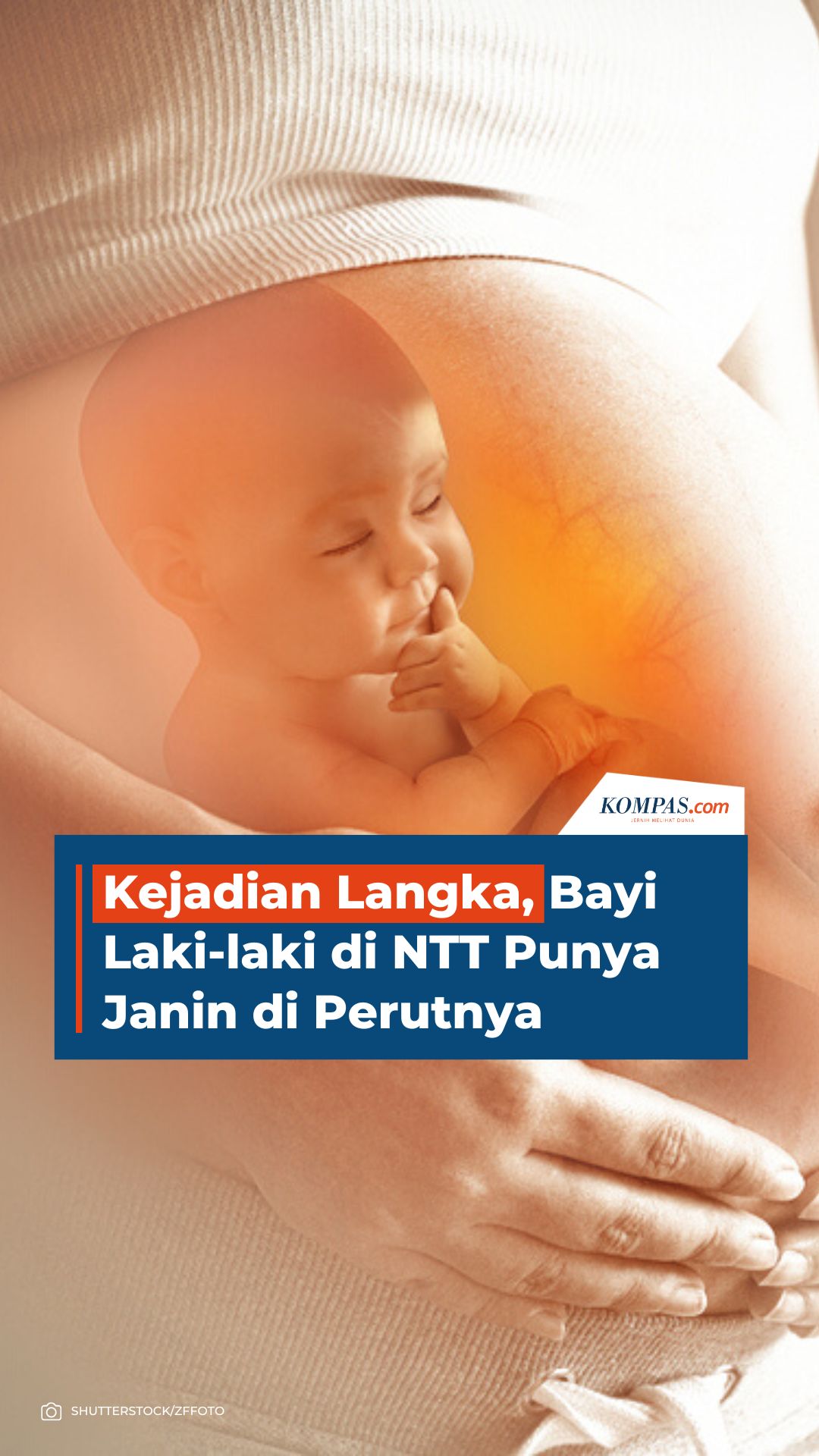 Fenomena Langka, Bayi Laki-laki di NTT Punya Janin di Perutnya