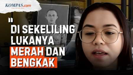 Dokter Temukan Luka Prada Lucky Di Punggung, Lengan, Dan Paha Alami Infeksi