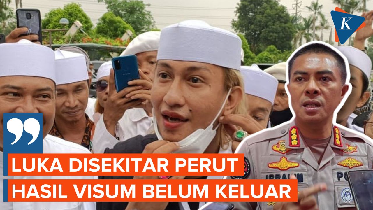 Penjelasan Polisi Terkait Luka Tembak Bahar bin Smith