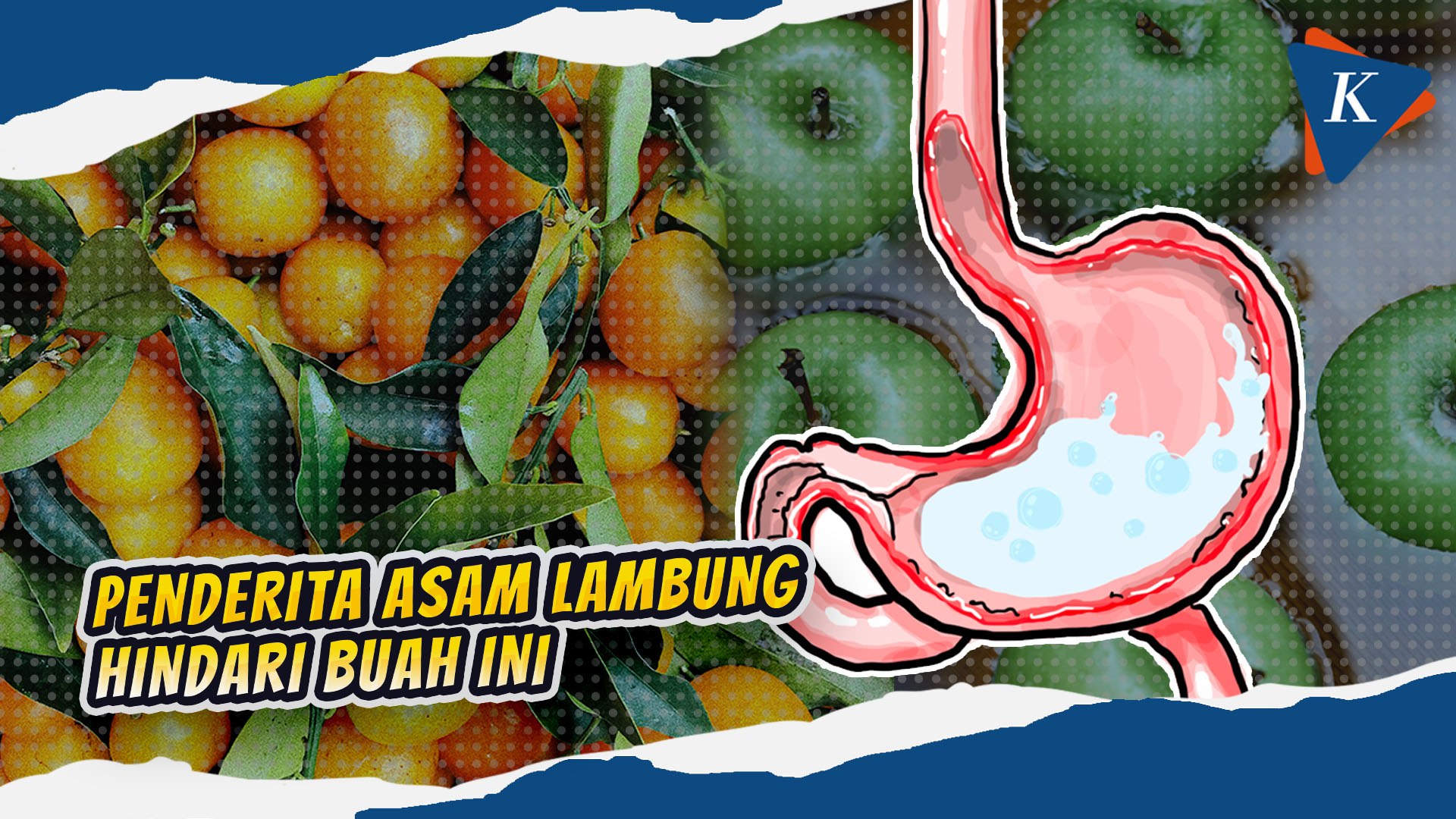 Penderita Asam Lambung, Jangan Konsumsi 4 Buah Ini!