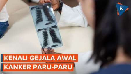 Gejala Kanker Paru-paru yang Perlu Diwaspadai