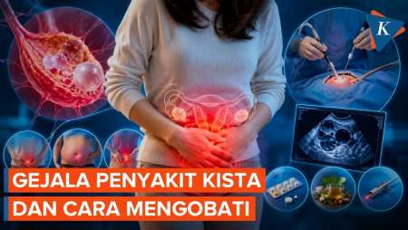 Kista, Apakah Berbahaya? Ini Penyebab, Gejala, Dan Cara Pengobatannya