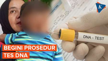 Orangtua Bayi Tertukar di Bogor Jalani Tes DNA, Bagaimana Prosedurnya?