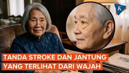 Tanda-tanda Stroke dan Penyakit Jantung yang Terlihat dari Wajah