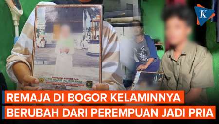 Remaja di Bogor Kelaminnya Berubah dari Perempuan Jadi Laki-laki, Harus Tunda Sekolah