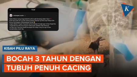 Raya, Kisah Tragis Bocah di Sukabumi Meninggal Usai Tubuh Dipenuhi Cacing
