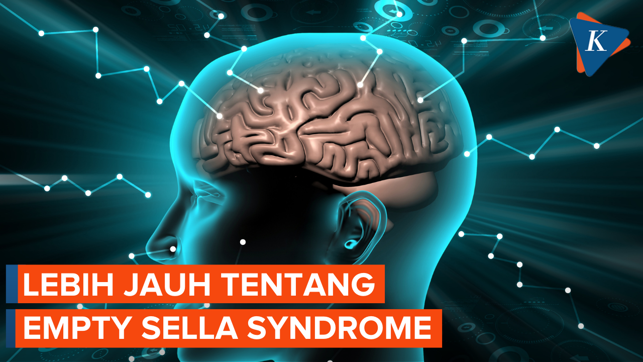 Apa itu Empty Sella Syndrome?