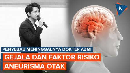 Dokter Azmi Meninggal akibat Aneurisma Otak, Kenali Gejala dan Cara Pencegahannya