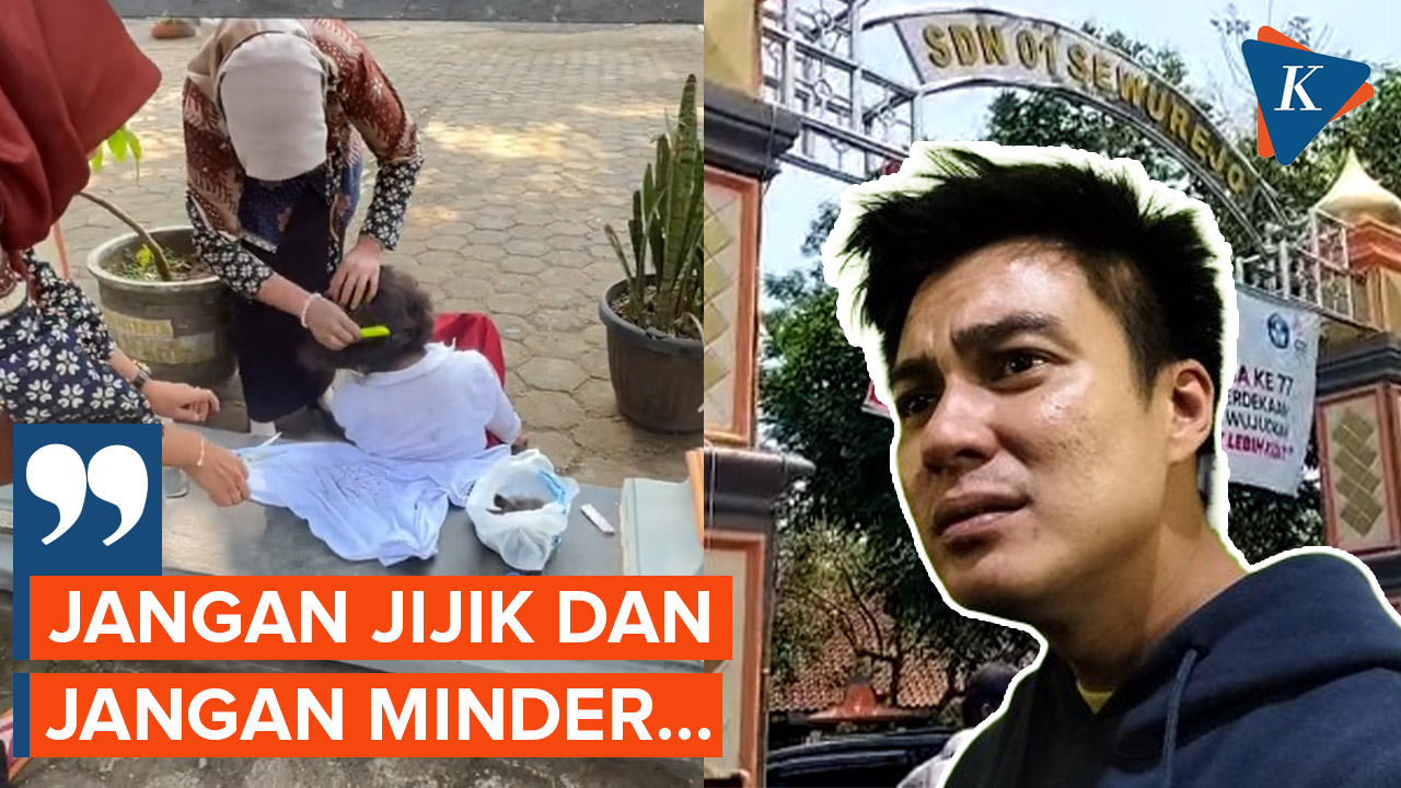 Baim Wong Bertemu Siswi SD yang Rambutnya Penuh Kutu