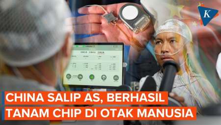 Salip AS! China Berhasil Tanamkan Chip ke Otak Manusia