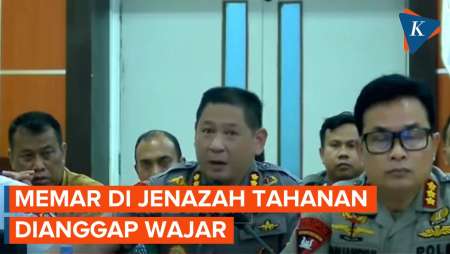 Kepala RS Bhayangkara Palu Sebut Lebam di Tubuh Bayu Adhityawan Hal yang Wajar