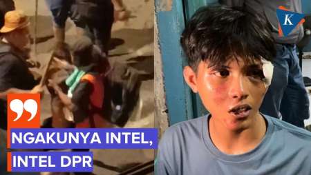 Lebam Sekujur Tubuh, Seorang Warga Mengaku Dianiaya Saat Ricuh Di Pejompongan