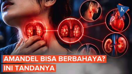 Amandel Sering Kambuh Bisa Picu Komplikasi, Kapan Harus ke Dokter?