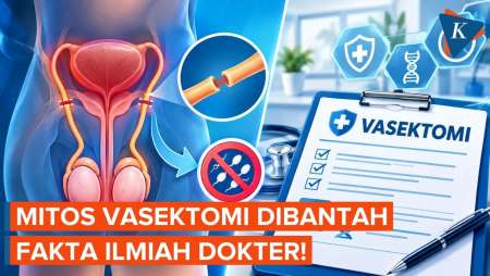 Apa Itu Vasektomi Yang Mitosnya Bisa Bikin Stamina Pria Menurun?