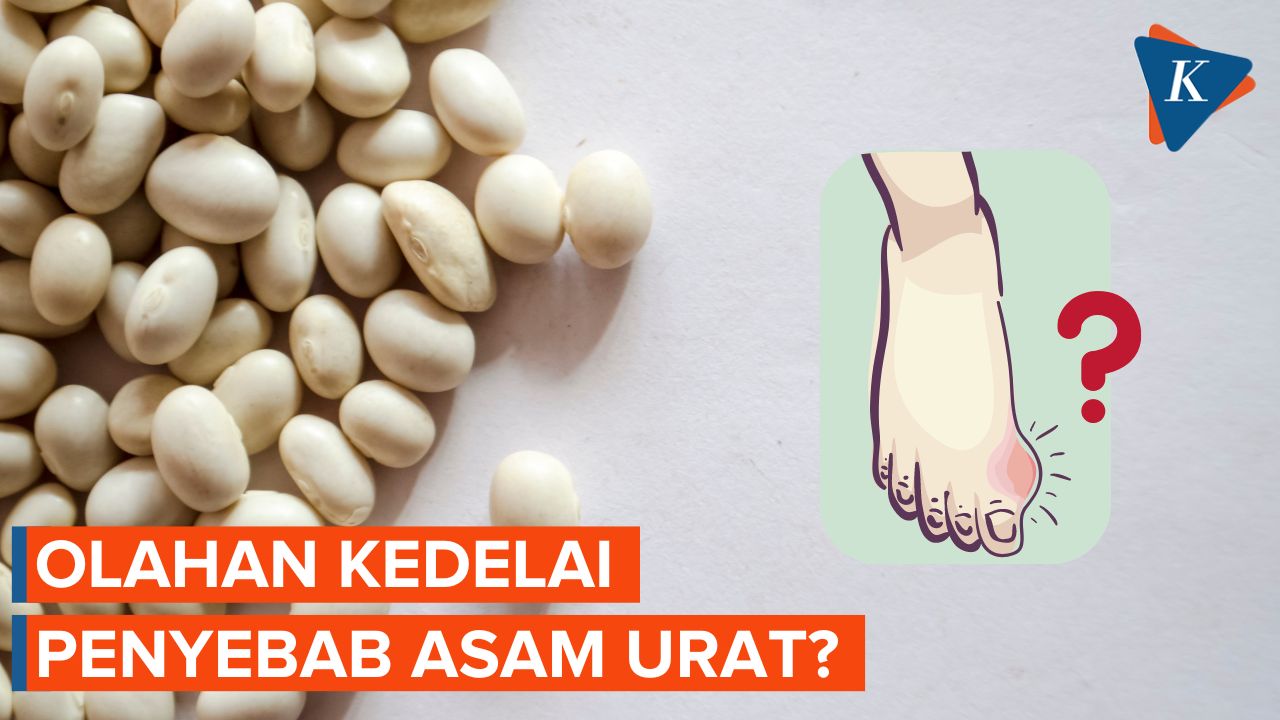 Benarkah Makan Tahu dan Tempe Dapat Sebabkan Asam Urat?