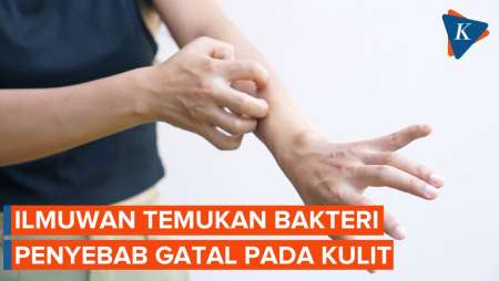 Akhirnya Ilmuwan Temukan Penyebab Gatal pada Kulit, Apa Itu?