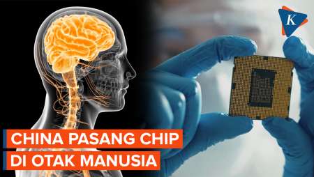 China Pasang Chip di Otak Manusia, Apa Fungsinya?